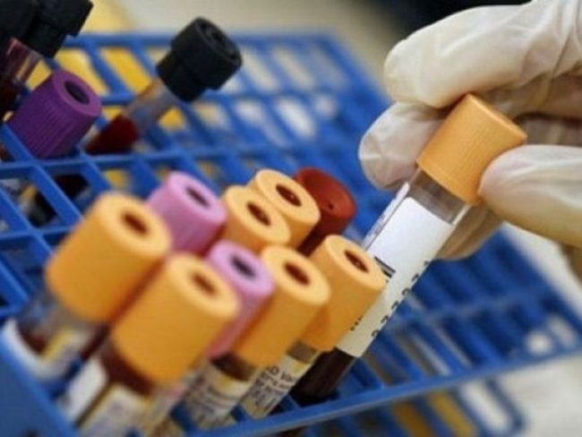 Legionella nell’acqua, chiuse le palestre del Centro Sportivo