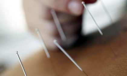 Quando l’agopuntura è abusiva: scoperto falso medico
