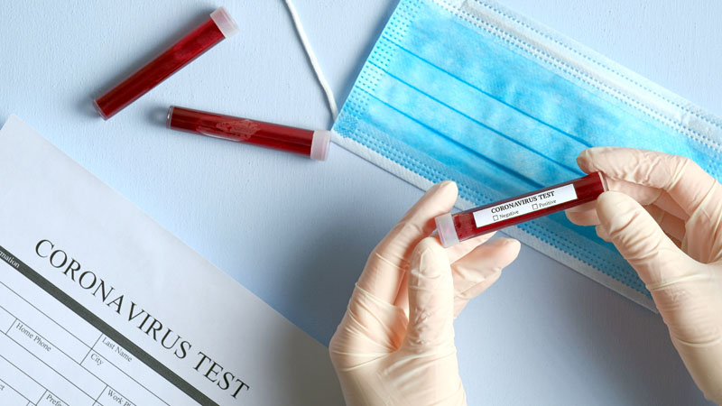 Coronavirus: scuole, sport, messe, “movida”. Tutti i punti della nuova ordinanza del Ministero