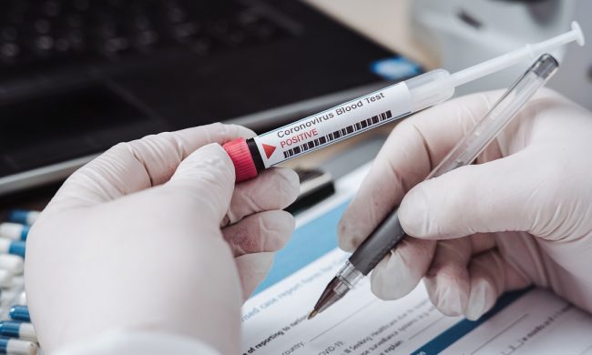 Sì ai test sierologici nei laboratori privati: ecco dove a Lodi e provincia