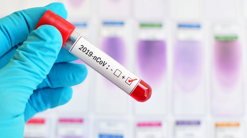 Coronavirus: in Lombardia 94 nuovi positivi. Nel Lodigiano ancora nessun nuovo contagio