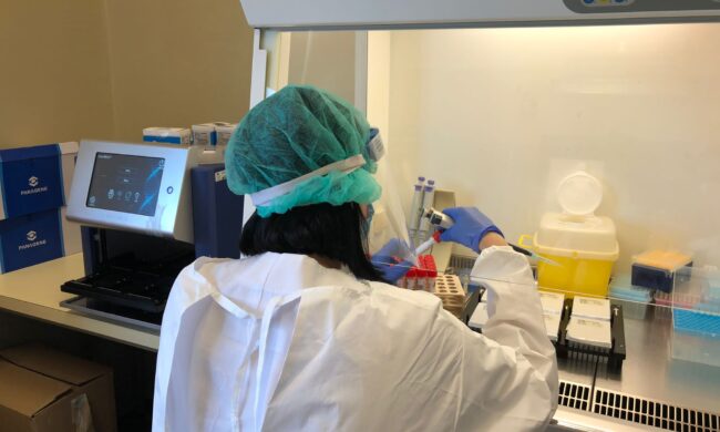 La variante Delta arriva nel Lodigiano, due positivi del settore logistico