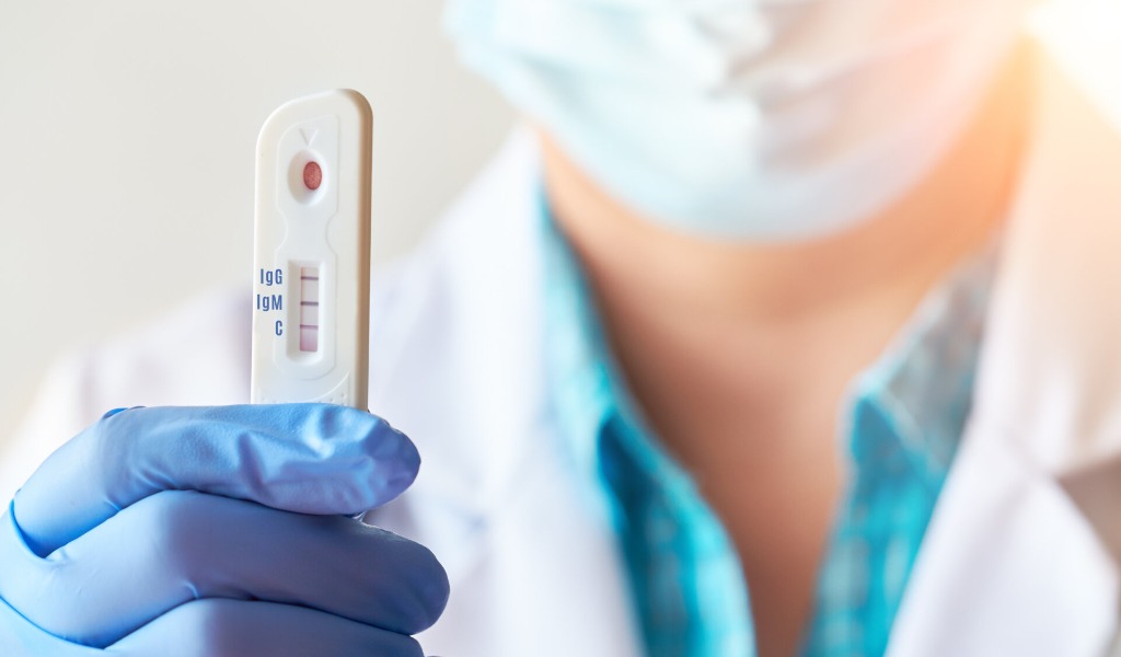 Non solo vaccinazioni: farmacie prese d’assalto per i tamponi rapidi