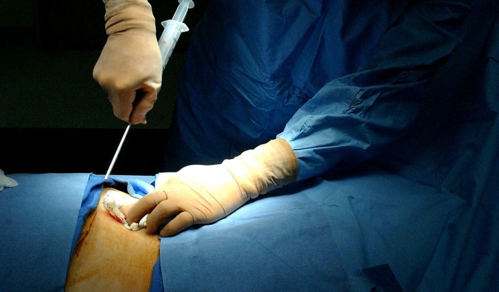 L’ASST di Lodi ottiene un riconoscimento come centro per il Trapianto autologo di Cellule Staminali Emopoietiche