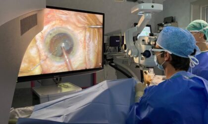 L’ASST di Lodi centro di riferimento extra-territoriale per la chirurgia complessa dell’occhio
