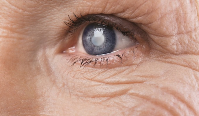 Settimana mondiale del Glaucoma: prevenzione e informazione con iniziative gratuite a Lodi