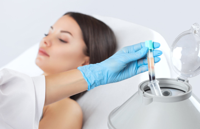 Quali sono le applicazioni del Plasma Ricco di Piastrine?