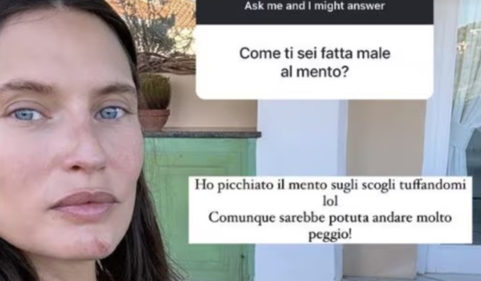 Incidente in vacanza per la modella lodigiana Bianca Balti: “Ho picchiato il mento sugli scogli tuffandomi”